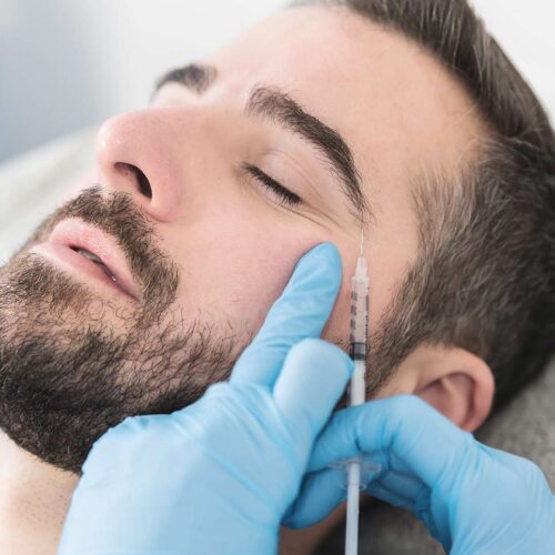 The Brotox Boom – why more men are getting Botox!