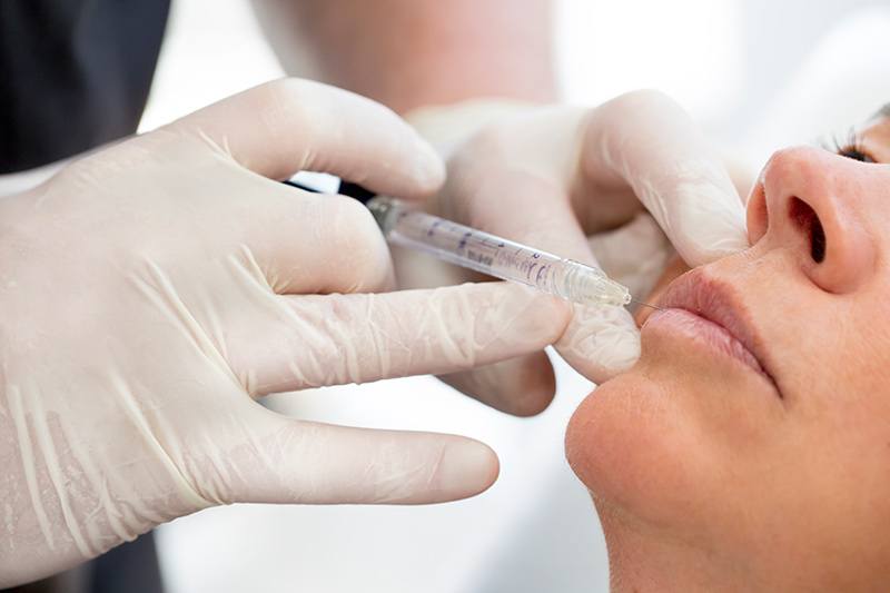 Lips and local anaesthetic injection